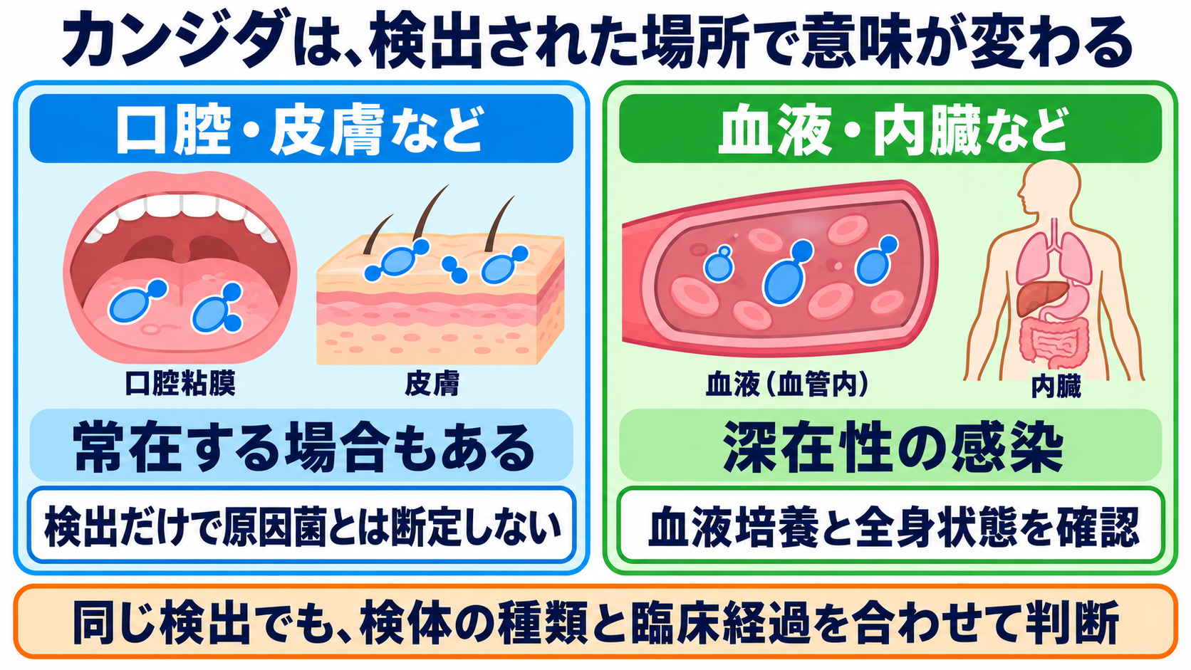主な感染症の一覧から、検査の目的と看護観察の要点を学ぶ：真菌・寄生虫の感染症では、常在性と渡航歴が判断を変えるの図解