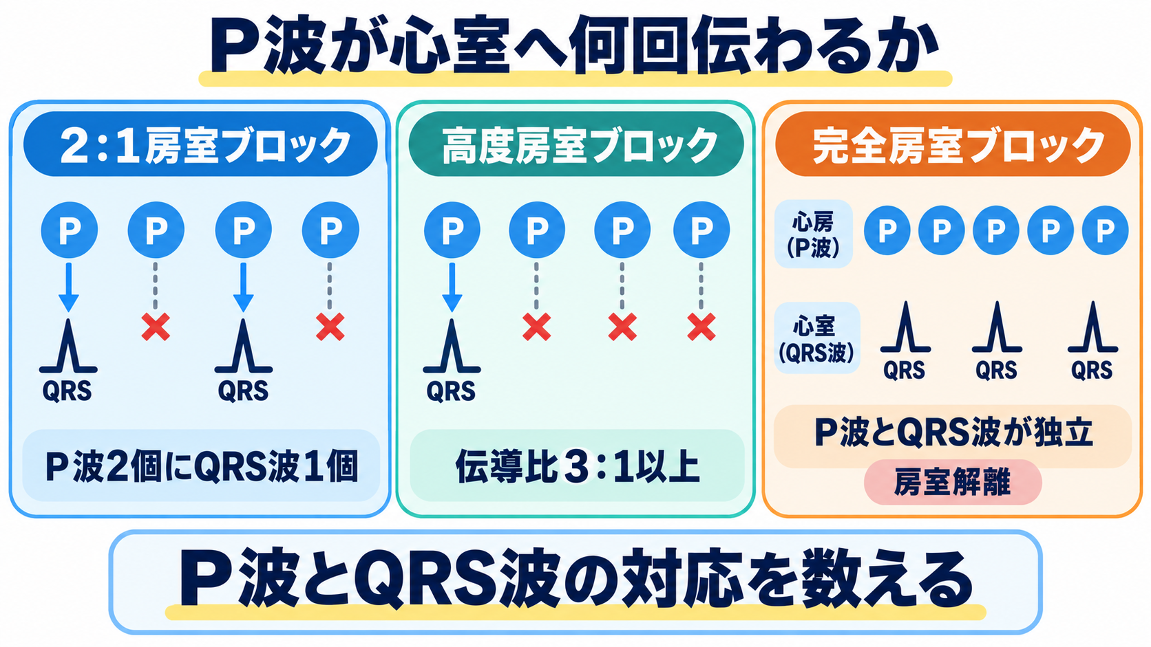 徐脈をどう見分ける？洞徐脈・SSS・徐脈頻脈症候群・房室ブロックの心電図と看護：2：1・高度・完全房室ブロックは、P波が心室へ何回伝わるかで区別するの図解