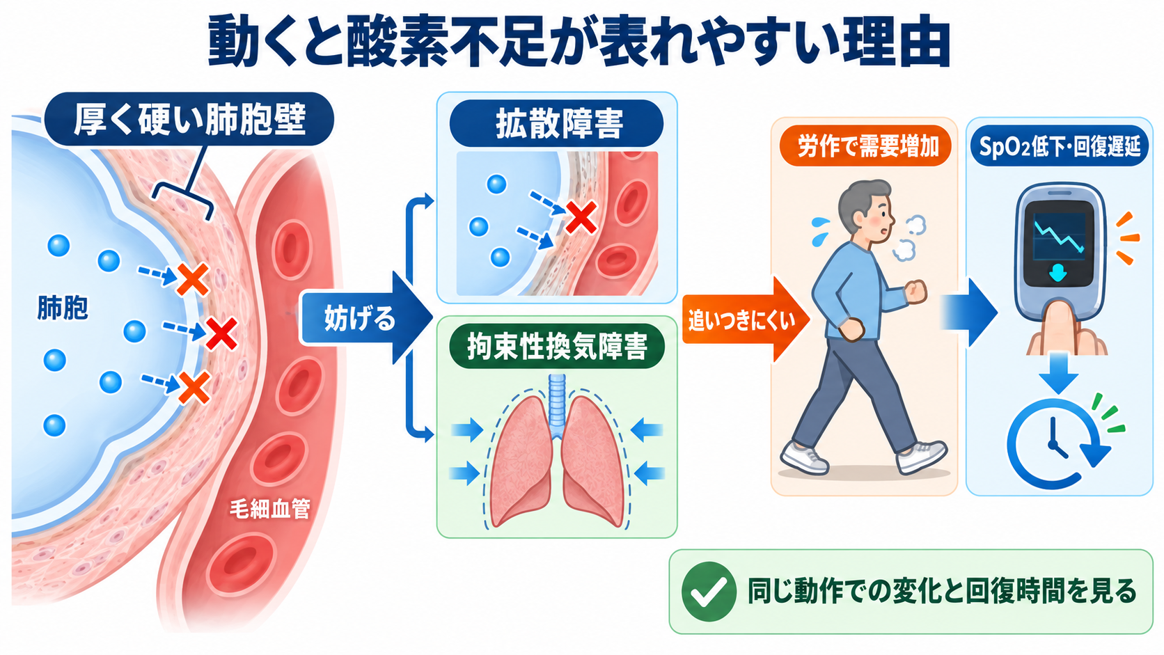 間質性肺疾患とは？病態・検査・治療から看護観察と急性増悪の見分け方まで：肺胞の壁が厚く硬くなると、動いたときに酸素不足が表れやすいの図解