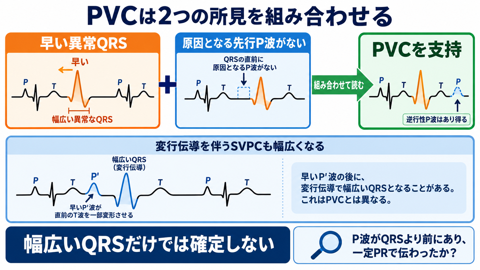予定よりP波・QRS波が早いときの読み方――PVC、間入性・代償性休止期、副収縮、SVPCの見分け方と分類：PVCは「早い異常QRS」と「原因となる先行P波がない」ことを組み合わせて読むの図解