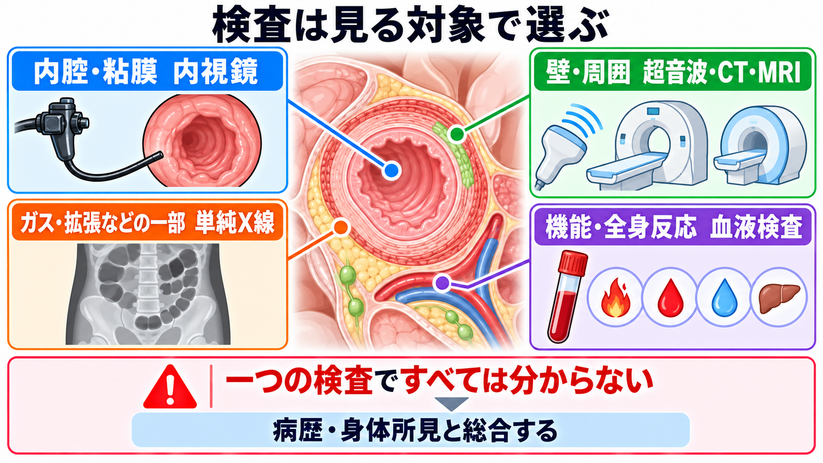 消化器の解剖を流れで理解する｜臓器・腹膜・血流と看護観察の意味：検査は「内腔・壁・周囲・機能」のどれを見るかで選ばれるの図解