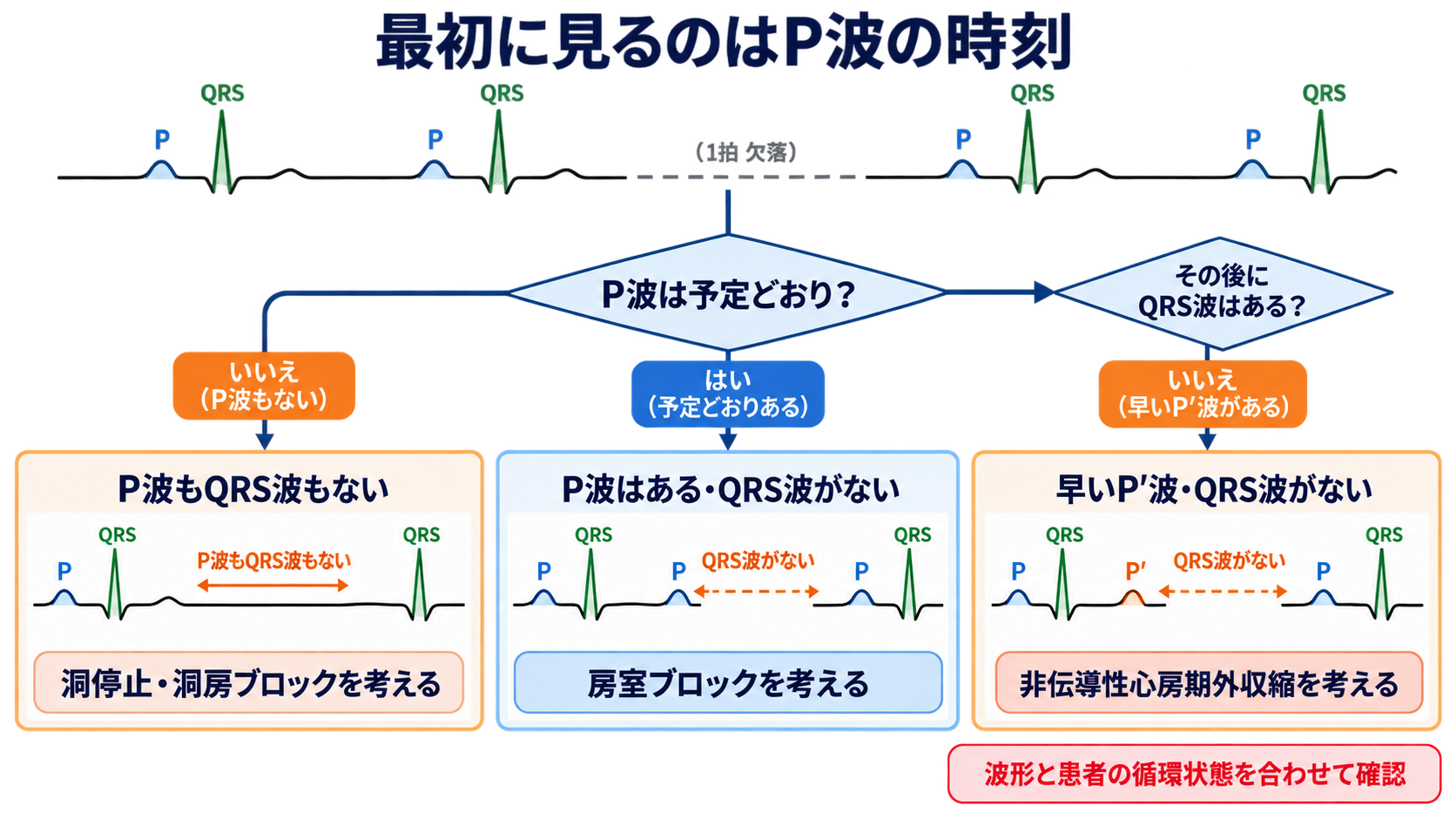 心電図でP波・QRS波が予定位置にないときの見分け方―洞停止、洞房ブロック、房室ブロック、ブロックSVPC：最初の結論：欠けた波より「P波の時刻」と「P波の後」を見るの図解