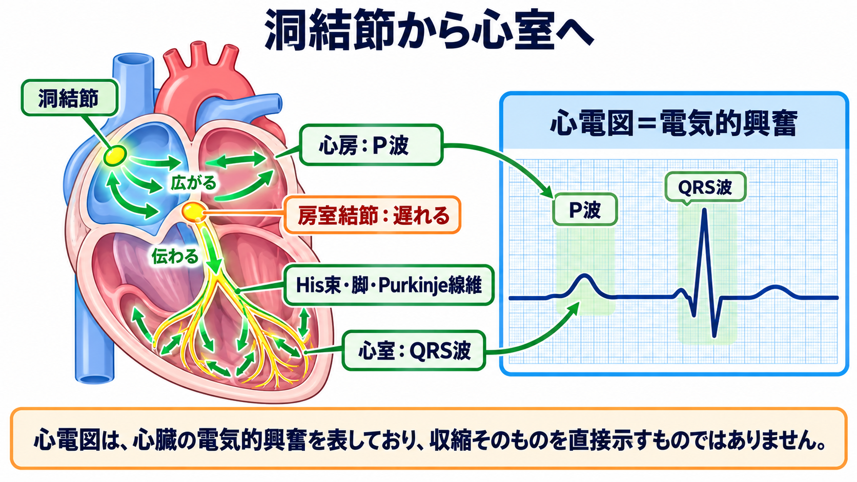 P-QRS関係で見分ける基本調律の異常―心房細動・接合部調律・固有心室調律・心房停止・洞室伝導：正常洞調律では、洞結節から心房、房室結節、心室へ順に興奮するの図解
