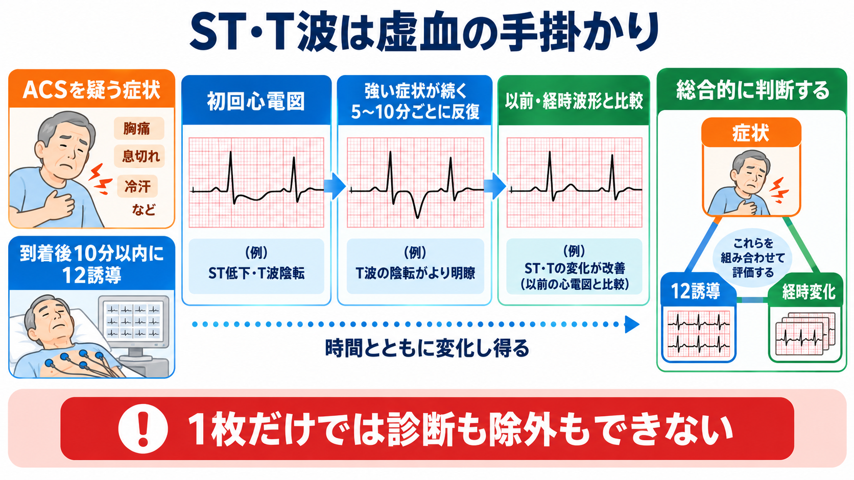 心電図の読み方を基礎から整理｜新人看護師・看護学生のための判読手順と緊急波形：ST・T波は虚血を考える手掛かりだが、1枚だけでは診断も除外もできないの図解
