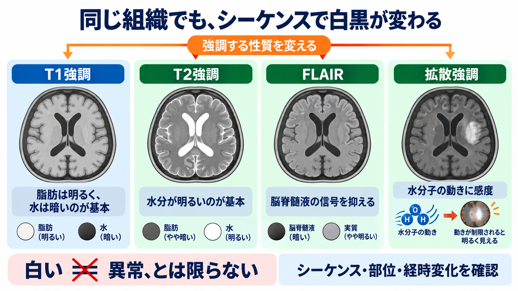 なぜ体の中が見える？CTとMRIを物理から理解する――画像の白黒と看護観察の意味：MRIでは同じ組織でも、強調する性質を変えると白黒が入れ替わるの図解