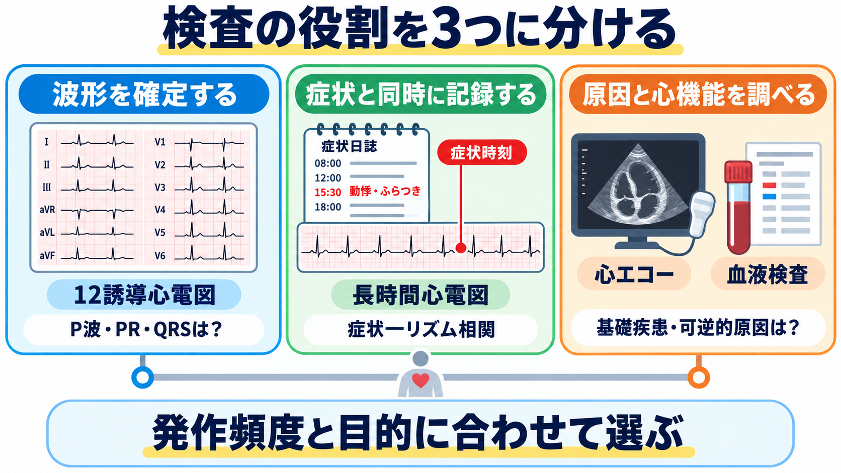 徐脈をどう見分ける？洞徐脈・SSS・徐脈頻脈症候群・房室ブロックの心電図と看護：検査は、波形の確定、症状との同時記録、原因と心機能の評価に分けるの図解