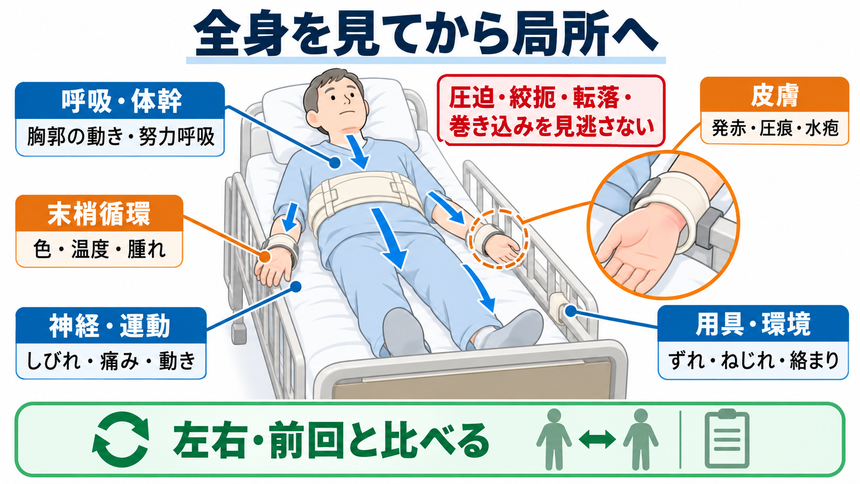 身体拘束中は何を観察する？安全・苦痛・原因・解除判断をつなぐ看護の見方：まず呼吸・循環・神経・皮膚と拘束具の位置から、今すぐ起こる危険を探すの図解