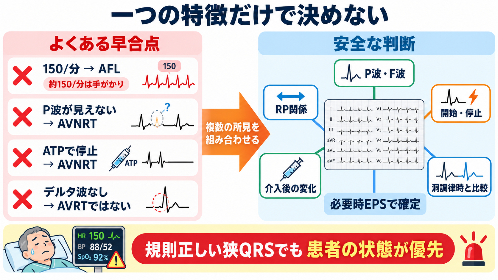 頻脈の見分け方：洞性頻脈・PSVT・AVNRT・AVRT・SANRT・AT・2:1心房粗動を順番に理解する：「150/分ならAFL」「ATPで止まればAVNRT」など、一つの特徴だけで決めないの図解