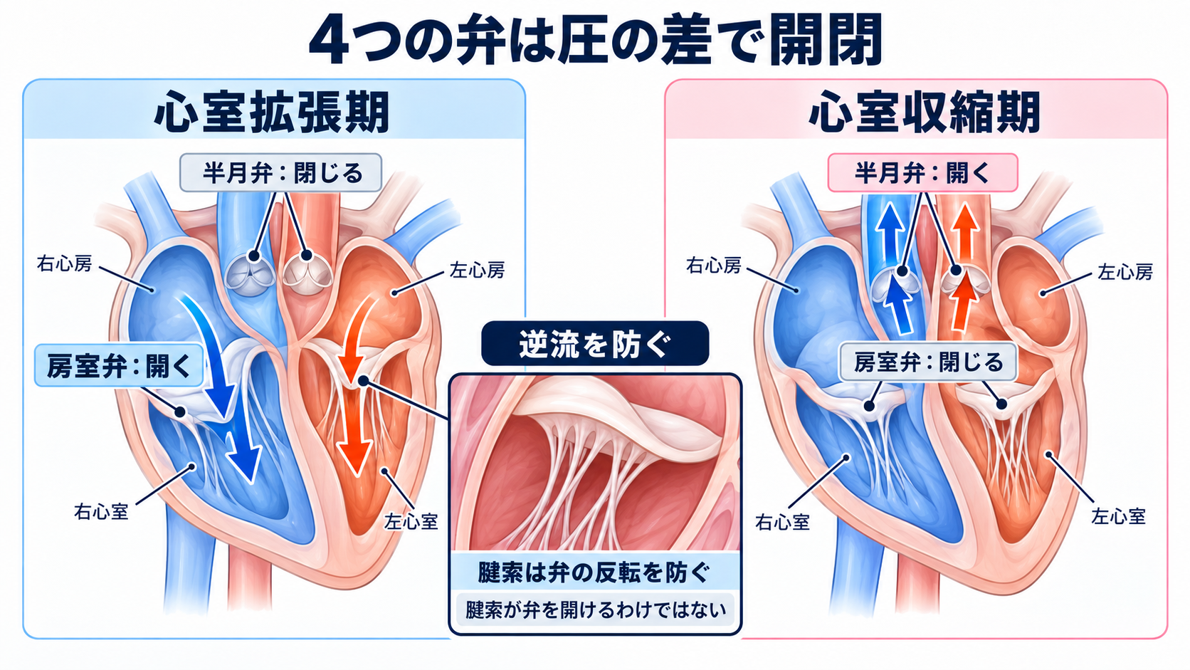 心臓の解剖を血流から理解する｜4つの部屋・弁・冠動脈・刺激伝導系と看護観察：4つの弁は圧の差で開閉し、血液の逆流を防ぐの図解