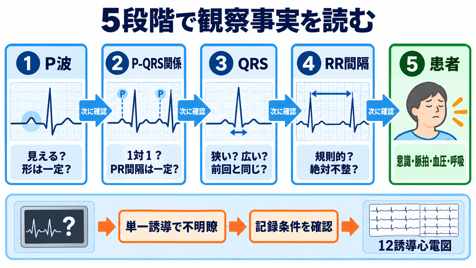 P-QRS関係で見分ける基本調律の異常―心房細動・接合部調律・固有心室調律・心房停止・洞室伝導：判読は「P→P-QRS→QRS→RR→患者」の5段階で進めるの図解