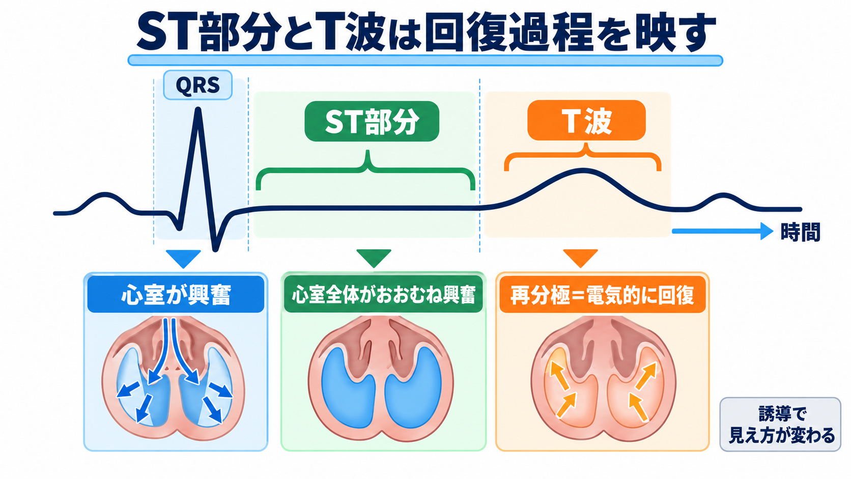 ST下降をどう読む？心筋虚血・心内膜下梗塞と二次性変化、薬剤・電解質異常の見分け方：ST部分とT波は、心室が興奮から回復する過程を別々の角度で示すの図解